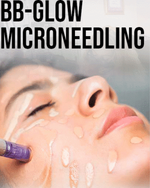 Curso de Micronnedling Bb-Glow