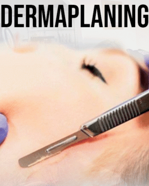 Curso de Dermaplaning